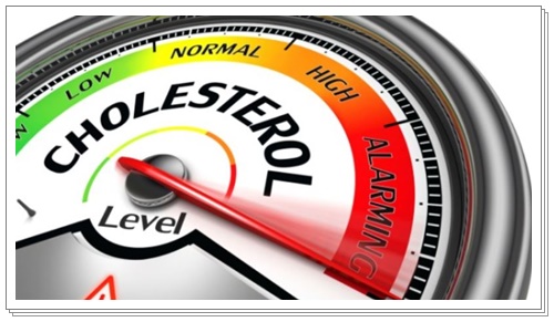 콜레스테롤 낮추는 음식, 높은이유, 영양제추천